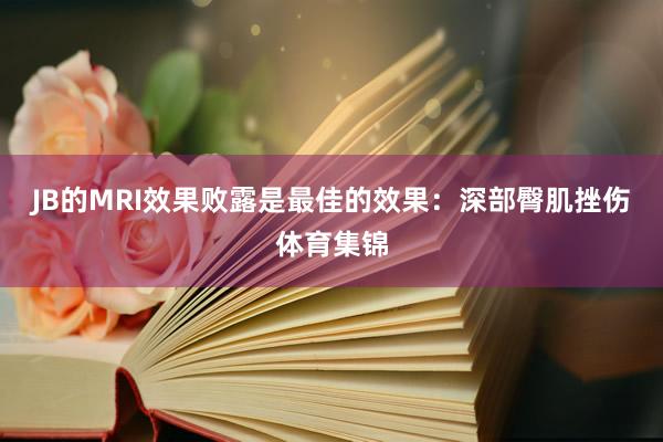 JB的MRI效果败露是最佳的效果：深部臀肌挫伤体育集锦